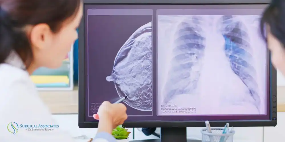 breast cancer stages breast cancer