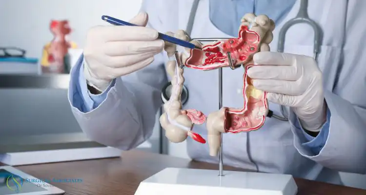 appendicitis surgery-2
