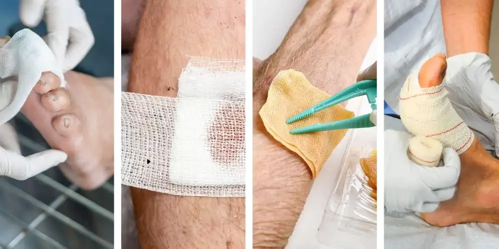 wound care (1)