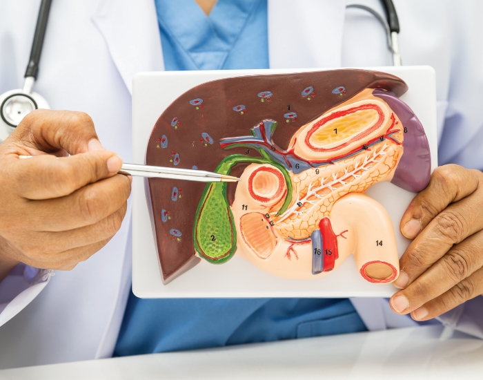 Gallbladder Removal Recovery Time: What to Expect After Surgery