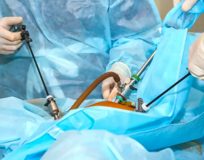 Robotic Gallbladder Surgery vs Laparoscopic | Key Differences & Benefits