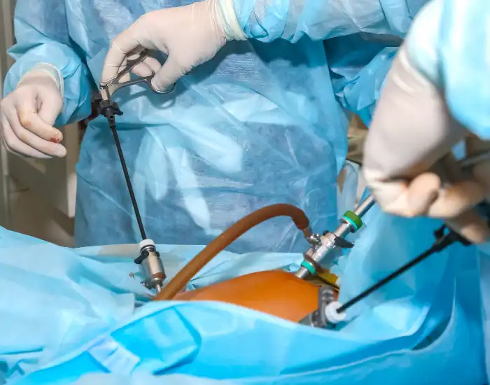 Is Laparoscopic Gallbladder Surgery Safe? Risks & Benefits Explained