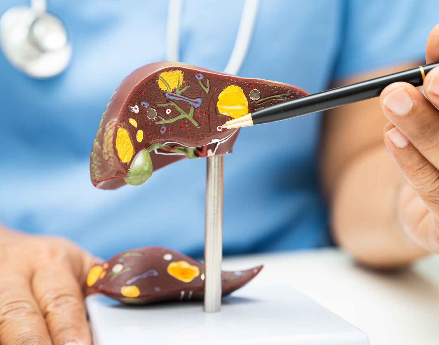 Liver Tumor vs Cyst Differences: Symptoms, Diagnosis & Treatment