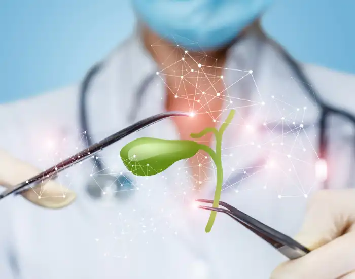 Long-Term Effects of Gallbladder Removal: What to Expect